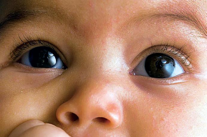 Remidio unveils breakthrough in AI-enabled.retinal imaging for newborns